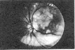 Fundus Photo #1