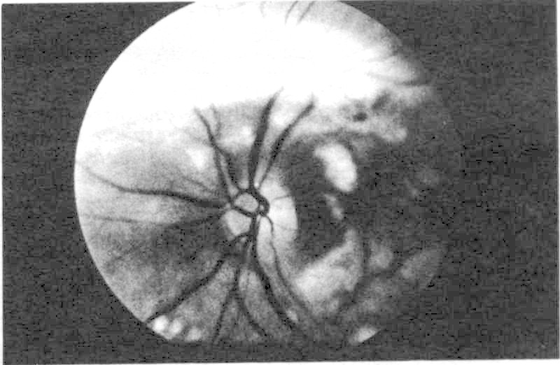 Pg 159 Fundus Photo #2