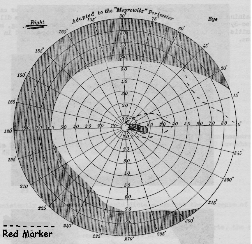 Pg 160 perimetry diagram